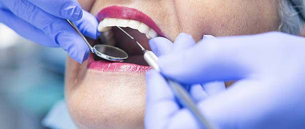 Best After-Hours Dental Care in Boulder Creek, CA